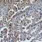 Anti-ERCC1 Antibody