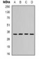 Anti-ERCC1 Antibody