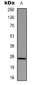 Anti-HSP27 Antibody