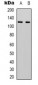 Anti-IDE Antibody