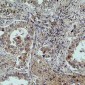 Anti-MICU1 Antibody