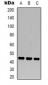 Anti-MKK2 Antibody