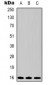 Anti-Survivin Antibody