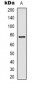 Anti-Transferrin Antibody