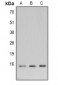 Anti-LC3B Antibody