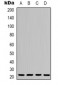 Anti-p21 Antibody