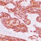 Anti-Cytokeratin 15 Antibody