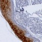 Anti-Cytokeratin 4 Antibody