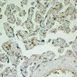 Anti-CD163 Antibody