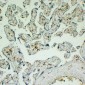 Anti-CD163 Antibody