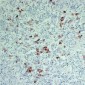 Anti-Thyrotropin beta Antibody