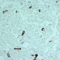 Anti-alpha Smooth Muscle Actin Antibody