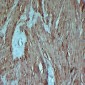 Anti-alpha Smooth Muscle Actin Antibody