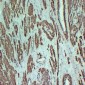 Anti-alpha Smooth Muscle Actin Antibody