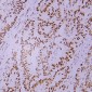 Anti-MSH2 Antibody