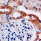 Anti-C4BP beta Antibody