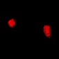 Anti-TPP2 Antibody