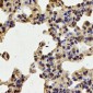 Anti-TPP2 Antibody