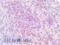 Goat Anti-IRF4 (aa393-407) Antibody