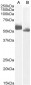 Goat Anti-IRF4 (aa393-407) Antibody