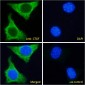 Goat anti-Connective Tissue Growth Factor Antibody