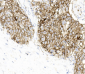 Recombinant PD-L1 antibody [AC37]
