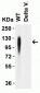 SARS-CoV-2 (COVID-19) Spike 156-157EF Antibody