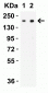 SARS-CoV-2 (COVID-19) Spike S2 Antibody [4F10]