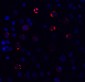 SARS-CoV-2 (COVID-19) Spike S2 Antibody [5E6]