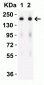 SARS-CoV-2 (COVID-19) Spike S2 Antibody [5E6]