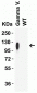 SARS-CoV-2 (COVID-19) Spike P26S (Gamma Variant) Antibody [5G12G11]