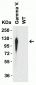 SARS-CoV-2 Spike P26S Antibody (Gamma Variant)