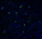 TMPRSS2 (CT) Antibody
