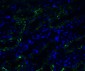 TMPRSS2 (CT) Antibody