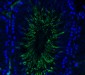 TMPRSS2 (CT) Antibody