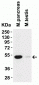 TMPRSS2 (CT) Antibody