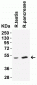 TMPRSS2 (CT) Antibody