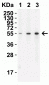 TMPRSS2 (CT) Antibody