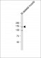 ITGA11 Antibody (N-term)