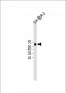 MYT1 Antibody (C-term)