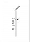 MYT1 Antibody (C-term)