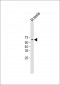 MYT1 Antibody (C-term)