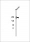 PTPRC Antibody (N-term)