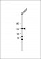 FLT3 (CD135) Antibody (N-term)