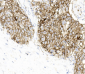 Recombinant PD-L1 antibody [BK58]