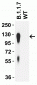 SARS-CoV-2 Spike P681H Antibody [1G8D11] (Alpha, Mu Variant)