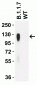 SARS-CoV-2 Spike P681H Antibody [7A4D12](Alpha, Mu Variant)