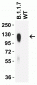 SARS-CoV-2 Spike P681H Antibody [9F7E4] (Alpha, Mu Variant)