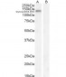 Goat Anti-ACE2 (C Terminal) Antibody