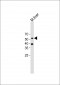 ARRB1 Antibody (C-term)